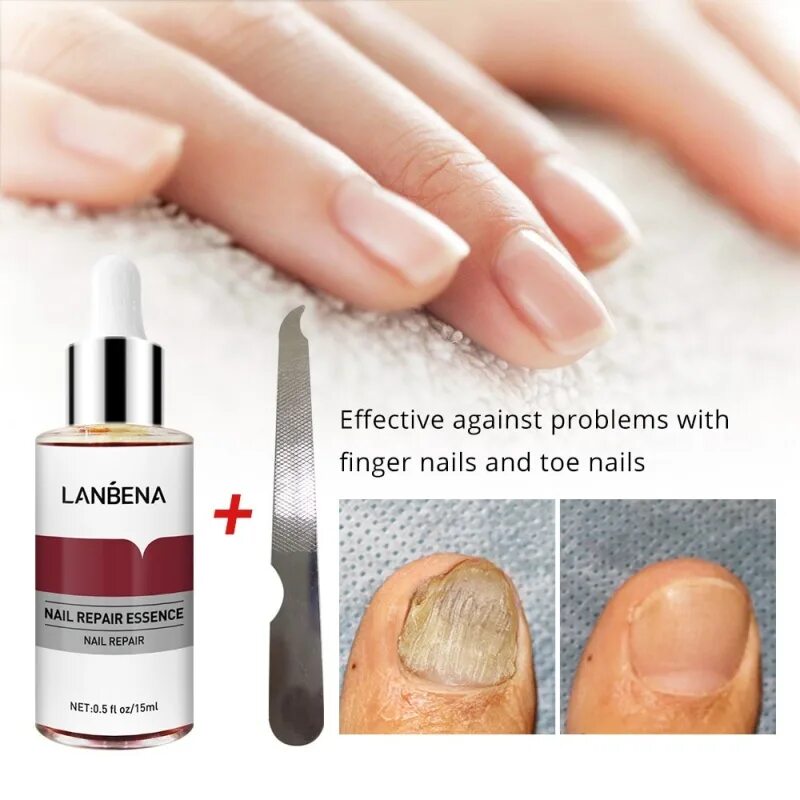 Средство от грибка ногтей LANBENA Nail Repair Essence 15 ml. Противогрибковое средство для ногтей LANBENA Nail Repair Essence 15 мл. LANBENA средство для здоровья ногтей LANBENA Nail Repair Essence Serum.