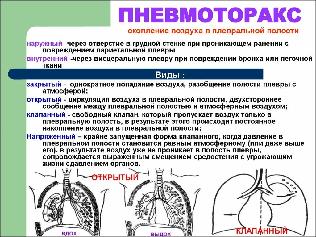 Звук в легких при дыхании. Давление в плевральной полости при пневмотораксе. Пневмотораксы закрытый,открытый,клапанный,напряжённый. Открытый клапанный пневмоторакс симптомы. Симптомы характерные для пневмоторакса.