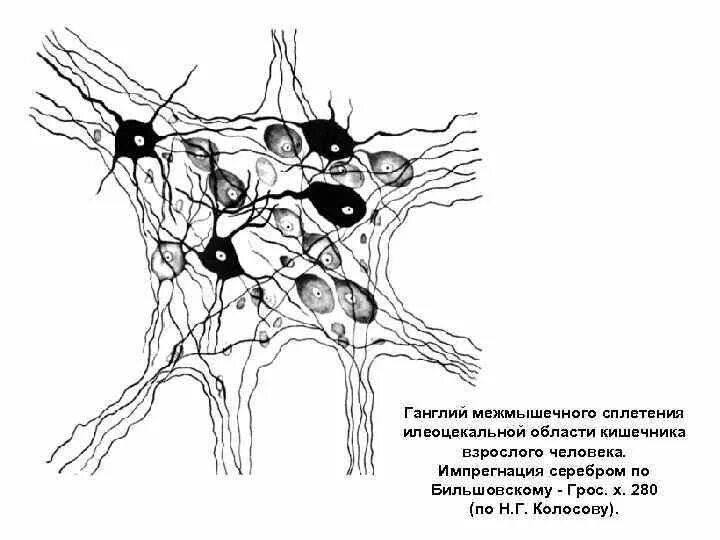 Нервные узлы сплетения. Вегетативный ганглий клетки Догеля препарат. Вегетативный ганглий клетки Догеля препарат гистология. Клетки Догеля гистология. Схема нервные клетки вегетативного ганглия.