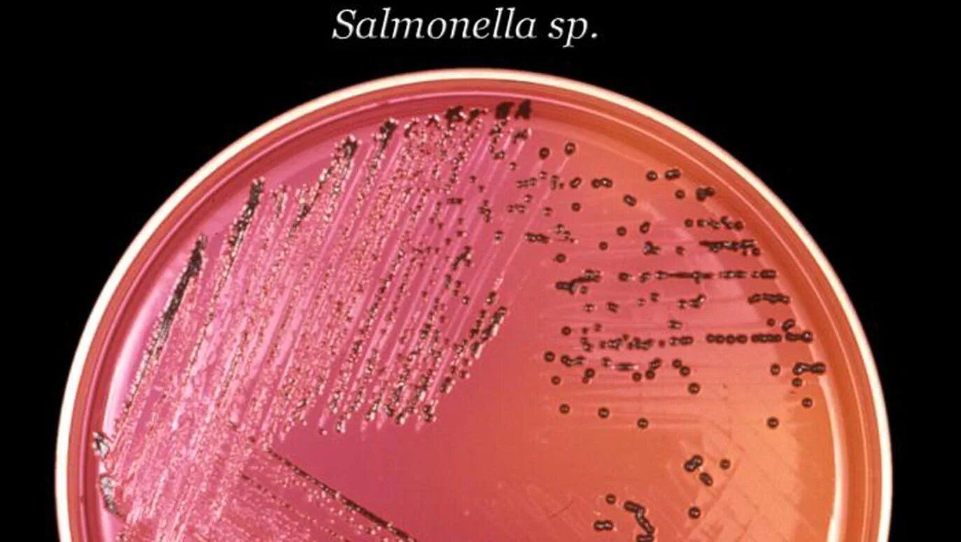 Spp salmonella spp shigella spp