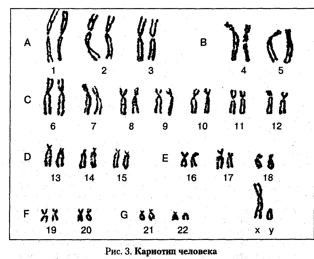 Хромосом группы d. Кариотип человека Денверская классификация. Классификация хромосом таблица. Денверская классификация хромосом человека. Кариограмма хромосом.