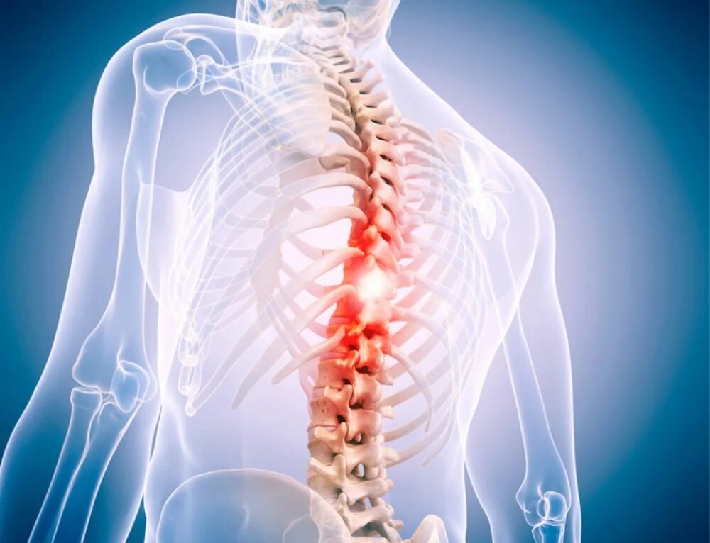 Ревматоидный артрит спины. Профессор позвоночник. Болезнь бехтерева позвонки. Золотой позвоночник. Спиной артрит.