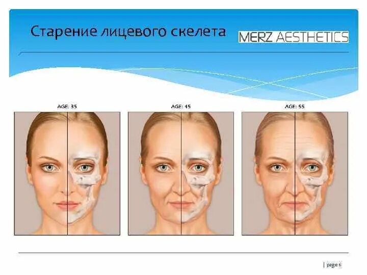 Основным признаком возрастных изменений костей. Старение лицевого скелета. Возрастные изменения лицевого скелета. Возрастные изменения лица. Возрастные деформации лица.