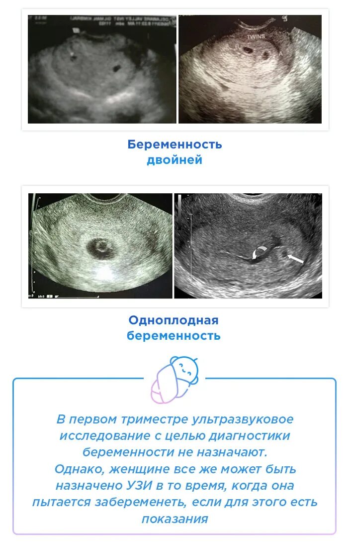 Когда можно увидеть беременность. УЗИ 1-2 недели беременности на ранних сроках беременности. 1 Неделя беременности по УЗИ. УЗИ 1 неделя беременности замершей. Эмбрион на 1 неделе беременности УЗИ.