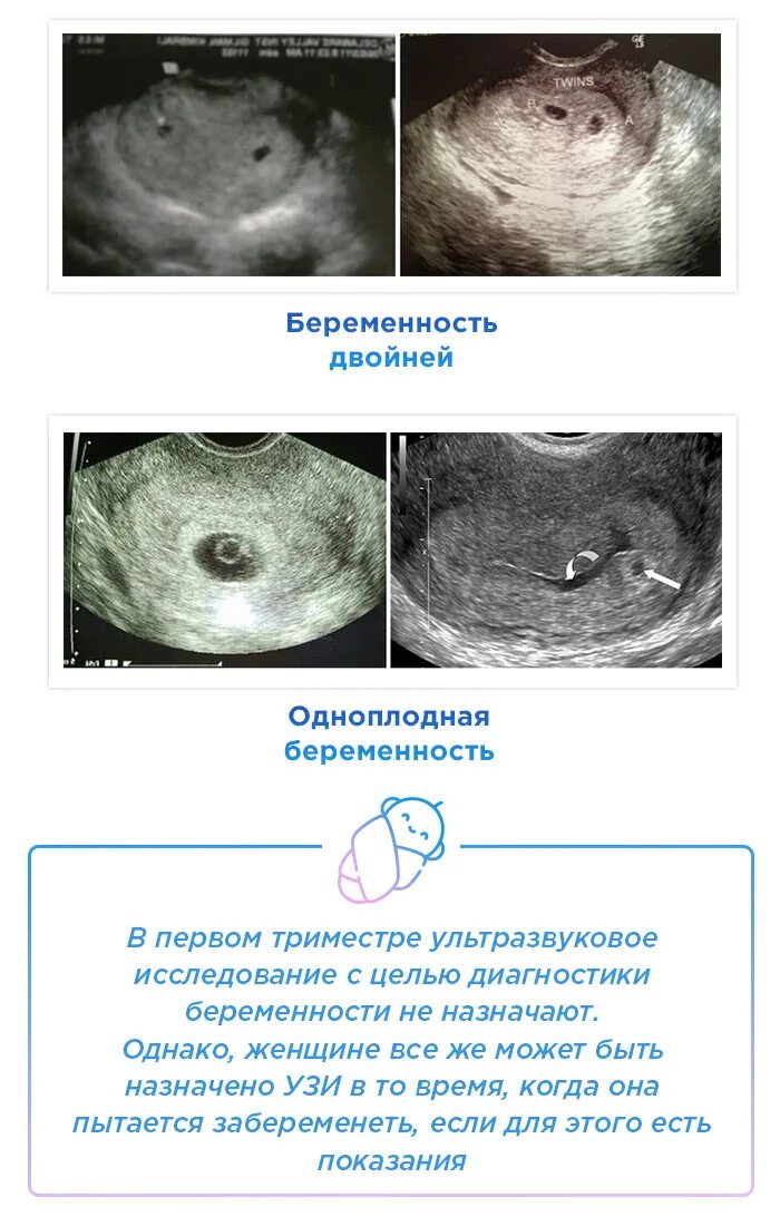 УЗИ 1-2 недели беременности на ранних сроках беременности. 1 Неделя беременности по УЗИ. УЗИ 1 неделя беременности замершей. Эмбрион на 1 неделе беременности УЗИ. На какой неделе узи увидит беременность