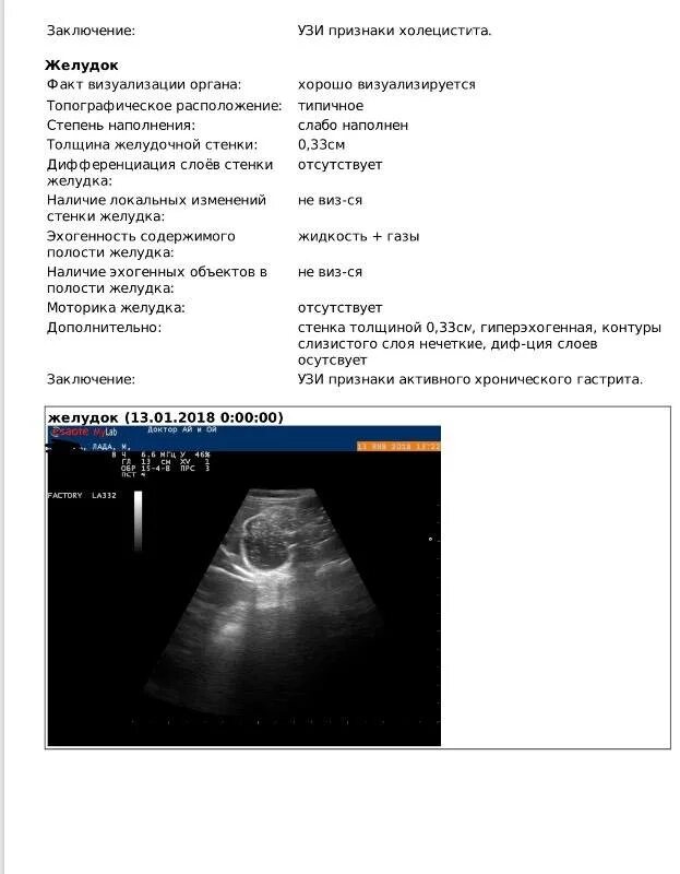 Ли узи. Гастрит УЗИ протокол. Хронический холецистит протокол УЗИ. Протокол УЗИ желудка у детей. УЗИ органов брюшной полости при гастрите заключение.