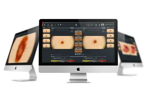 Fotofinder