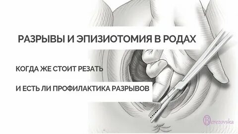 Распущенные волосы во время родов