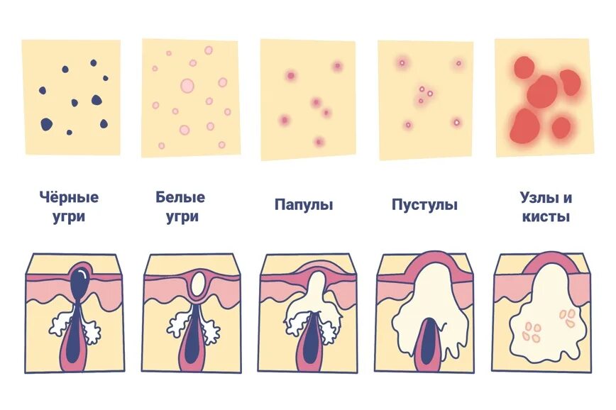 Почему боли полового члена