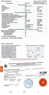 Тератозооспермия можно забеременеть