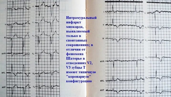 Экс примеры