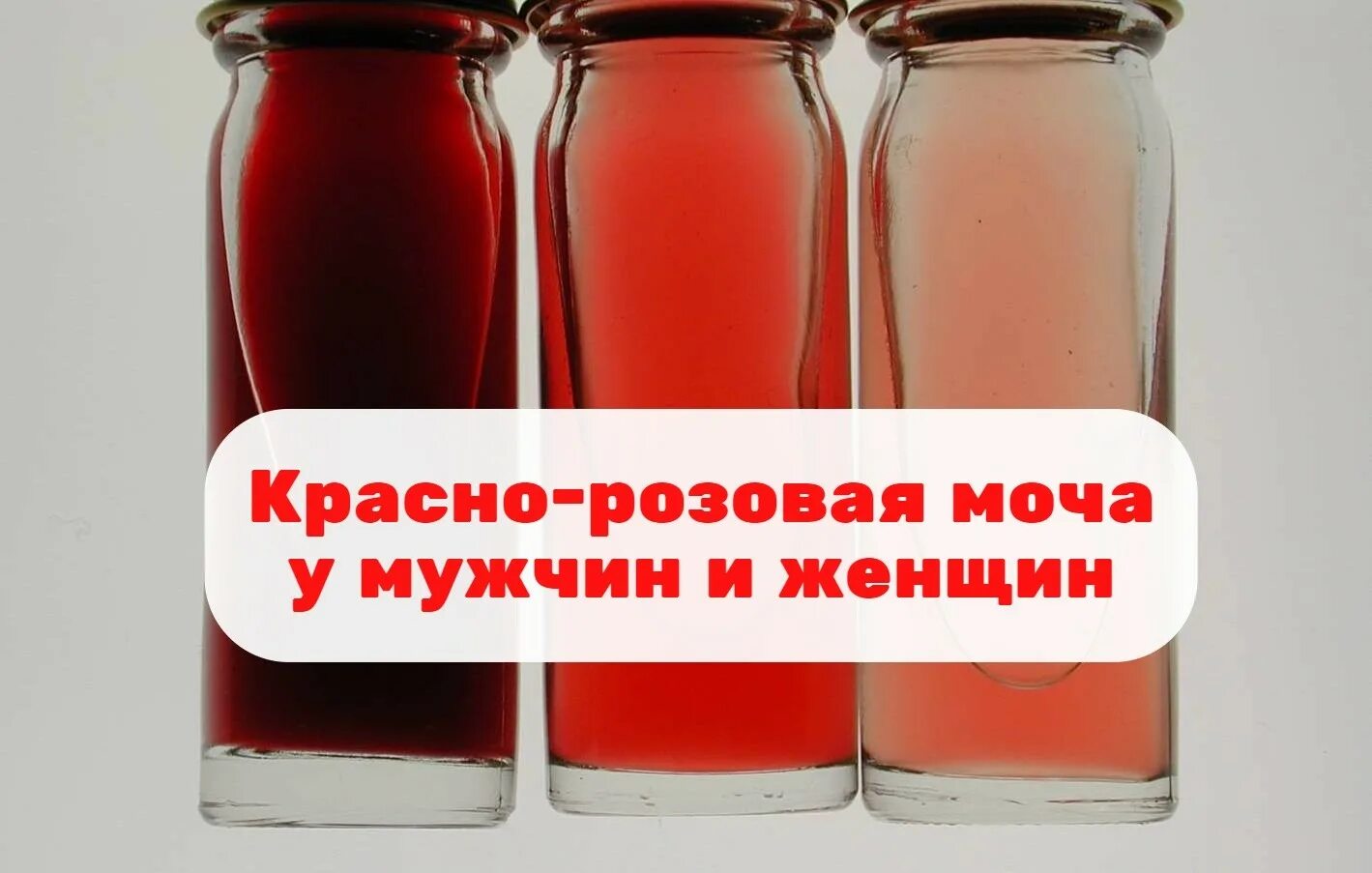 Моча розового цвета у ребенка. Моча розового цвета у ребенка