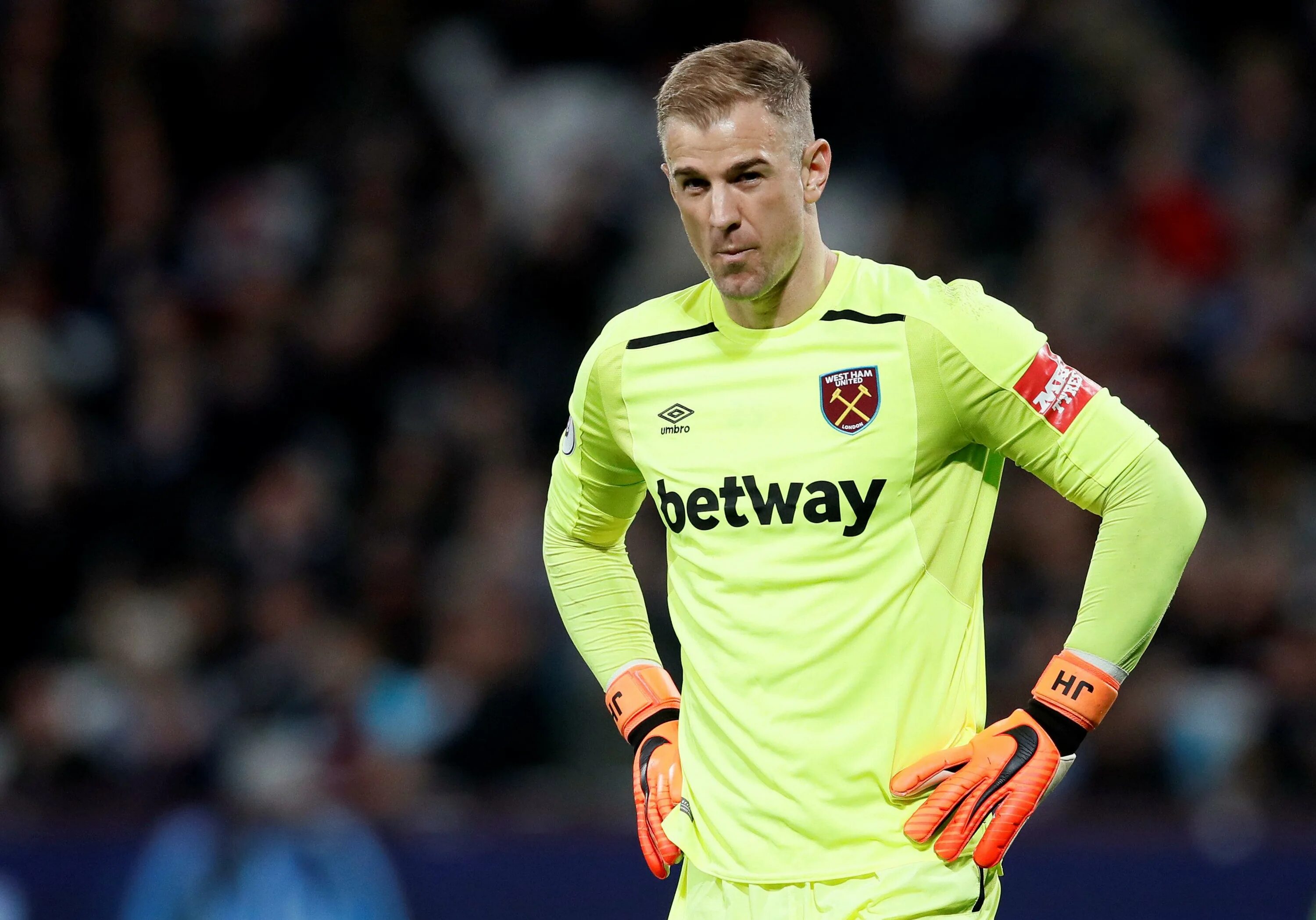 Где играет джо. Joe hart. джо харт манчестер сити. харт вратарь. джо харт селтик.