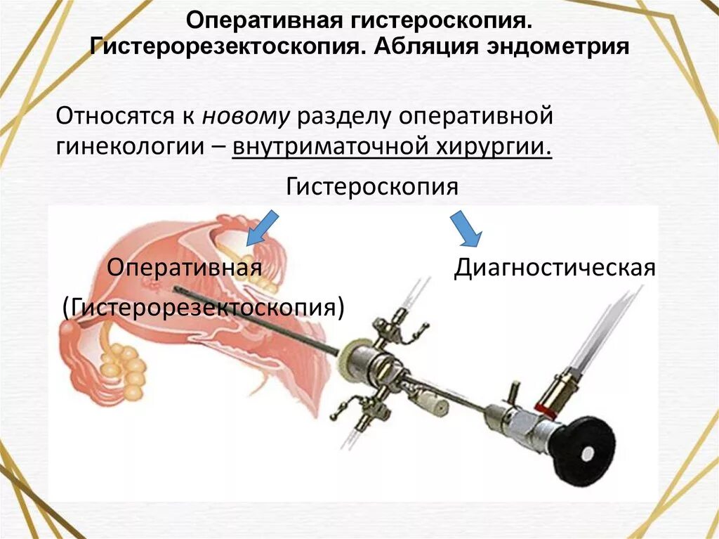 Удаление полипа в матке послеоперационный. Гистерорезектоскопия 1 степени сложности. Гистерорезекция полипа эндометрия. Абляция эндометрия гистероскопическая. Гистерорезектоскопия гиперплазия эндометрия.