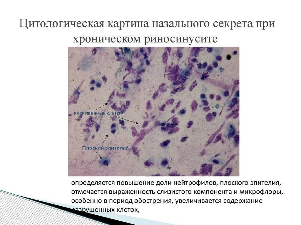 Микроскопическое исследование назального секрета