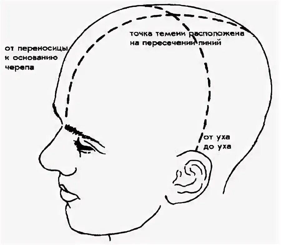 Теменная кость черепа у ребенка. Схема распределения капсул при наращивании волос. Схема разделения волос при наращивании. Части зон головы. Точка бай хуэй макушка.