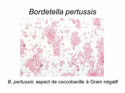 Bordetella pertussis что