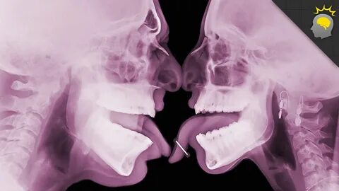 Throat x