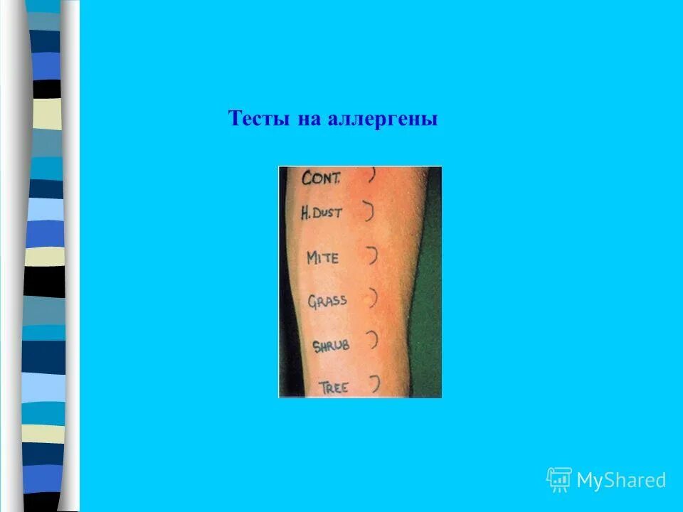 Тест по неврологии с ответами. Аллергены тесты с ответами. Алгоритм при острых аллергических реакциях. Контрольная работа по химии 10 класс алкены с ответами. Провокационные аллергические тесты.