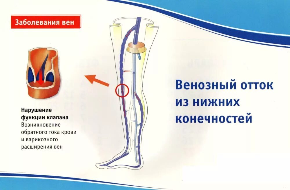 Строение вен нижних конечностей клапаны. Клапаны сосудов нижних конечностей. Венозные клапаны нижних конечностей человека. Вены ног клапаны