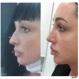 Косметология анны