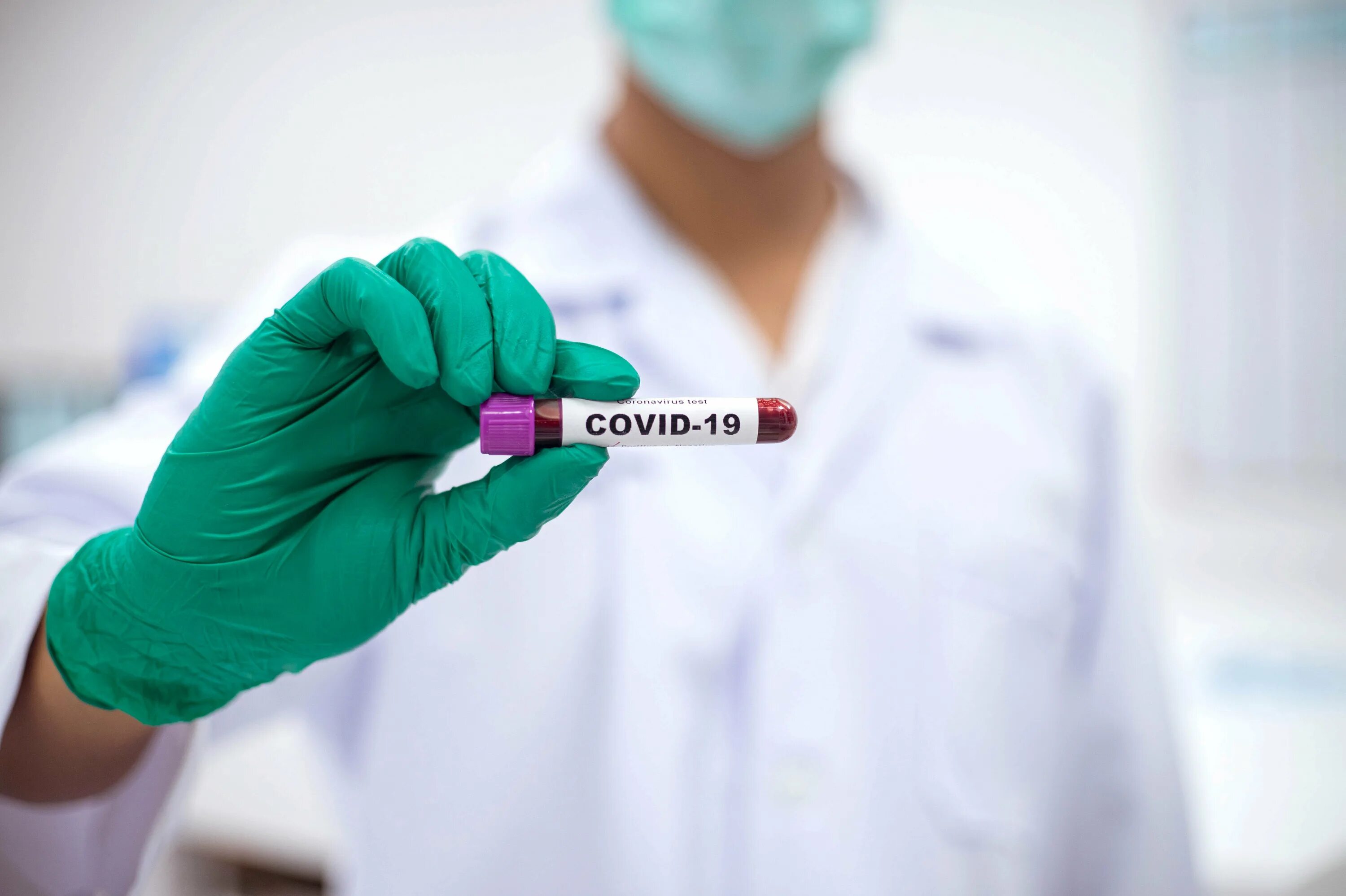Virus testing