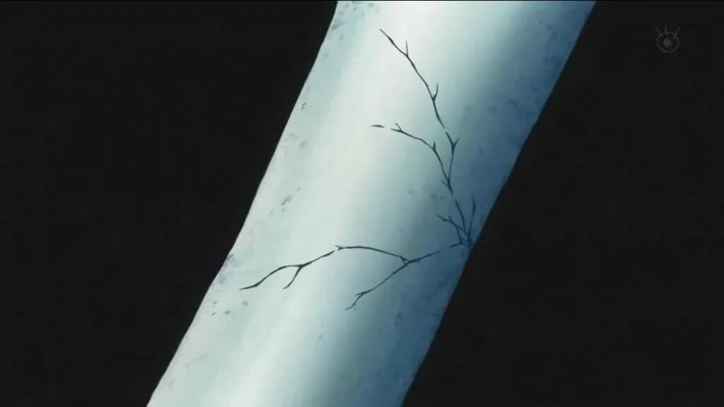 Гипсование перелом малоберцовой кости. Щель в кости. Щель в кости. Перелом бугра пяточной кости. Рентген оскольчатый перелом лучевой кости.