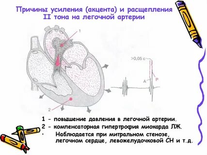 Легочной тон