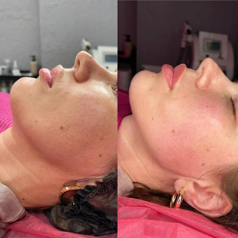 косметолог керчь на всесоюзной 1. Cmd керчь. олеандр керчь косметолог. клиника лазерной косметологии в чебоксара. лазерная косметология рязань.