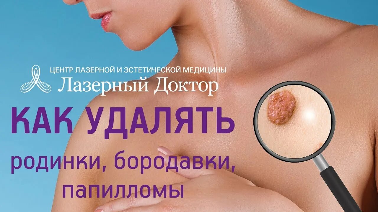 Как выглядит место после удаления родинки лазером Удаление папиллом и фибром фото презентация