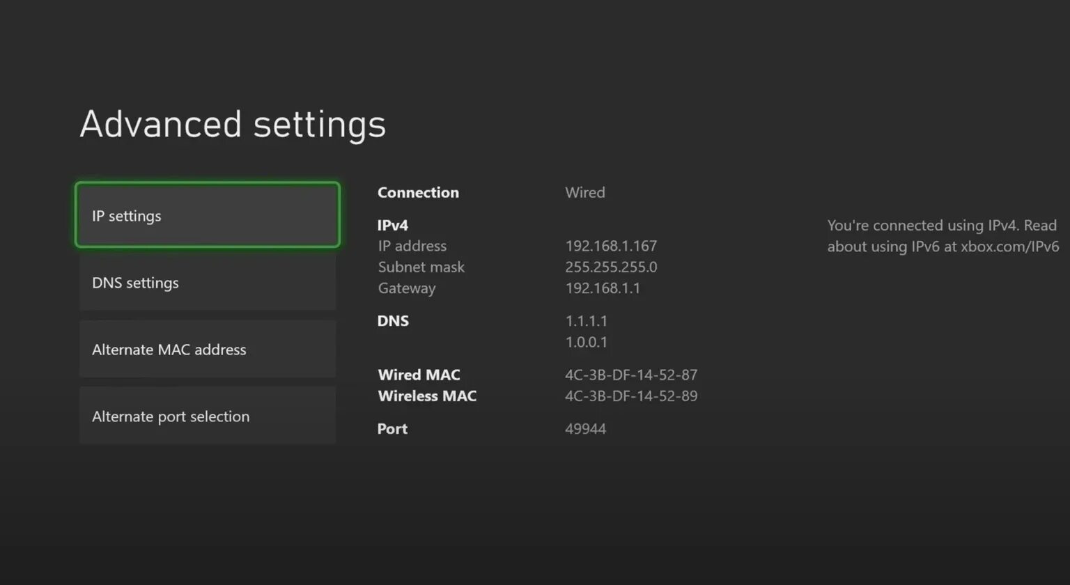 Dns сервер для xbox series s. Днс сервера для xbox series s. xbox dns сервер. xbox one s dns. параметры днс к xbox.