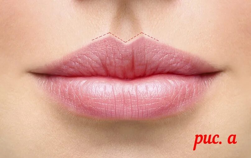Коррекция губ. Губы арка. Губы арка купидона гиалуронка. Губы арка. Перманентный макияж на тонкие губы.