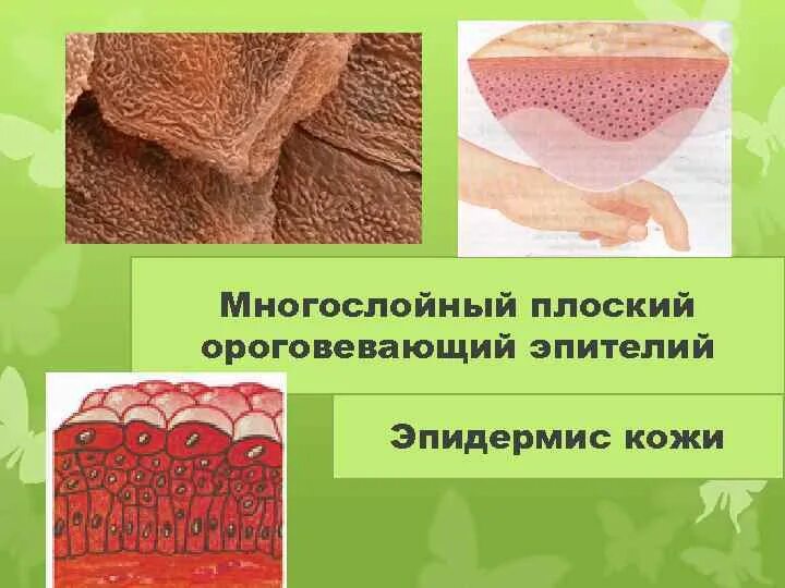 Сухая ороговевающая кожа