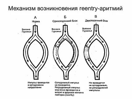 Re entry