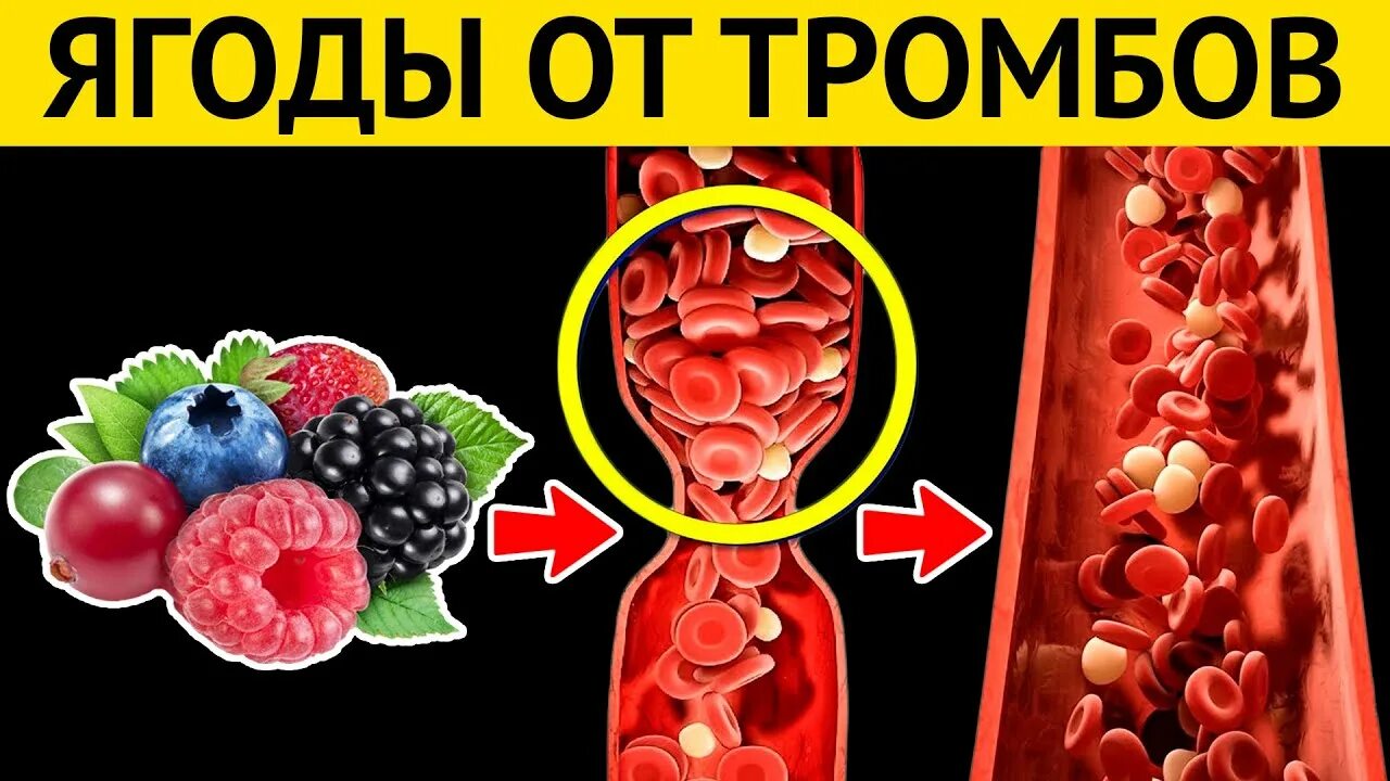 Продукты растворяющие тромбы. Продукты для профилактики тромбоза. Профилактика от тромбов в сосудах. Профилактика тромбообразования. Препараты для предотвращения образования тромбов в сосудах.