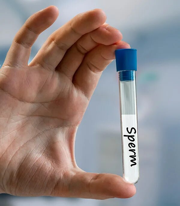 Спермограмма анализ норма. Сперматозоиды в пробирке. Сдача спермограммы. Донор семенной жидкости. Спермограмма анализ.