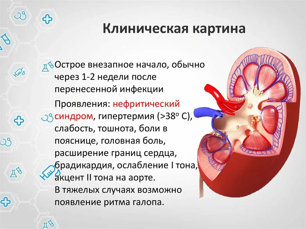 Гломерулонефрит эритроциты. Клиническая картина острого гломерулонефрита. гломерулонефрит клиническая картина. острый гломерулонефрит презентация. клиническая картина хронического гломерулонефрита.