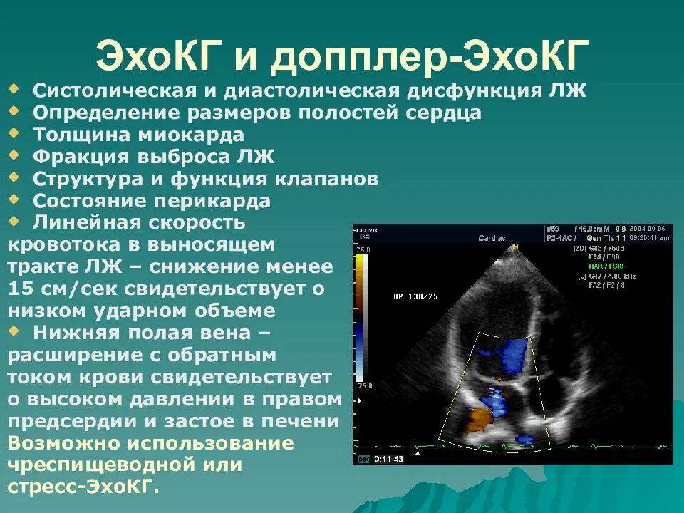 Что определяет доплер. Импульсный допплер эхокардиография аппарат. Методика ЭХОКГ. ЭХОКГ методика проведения. ЭХОКГ (УЗИ сердца) + допплер.