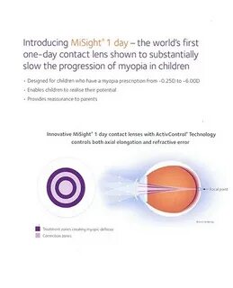 Линзы misight отзывы