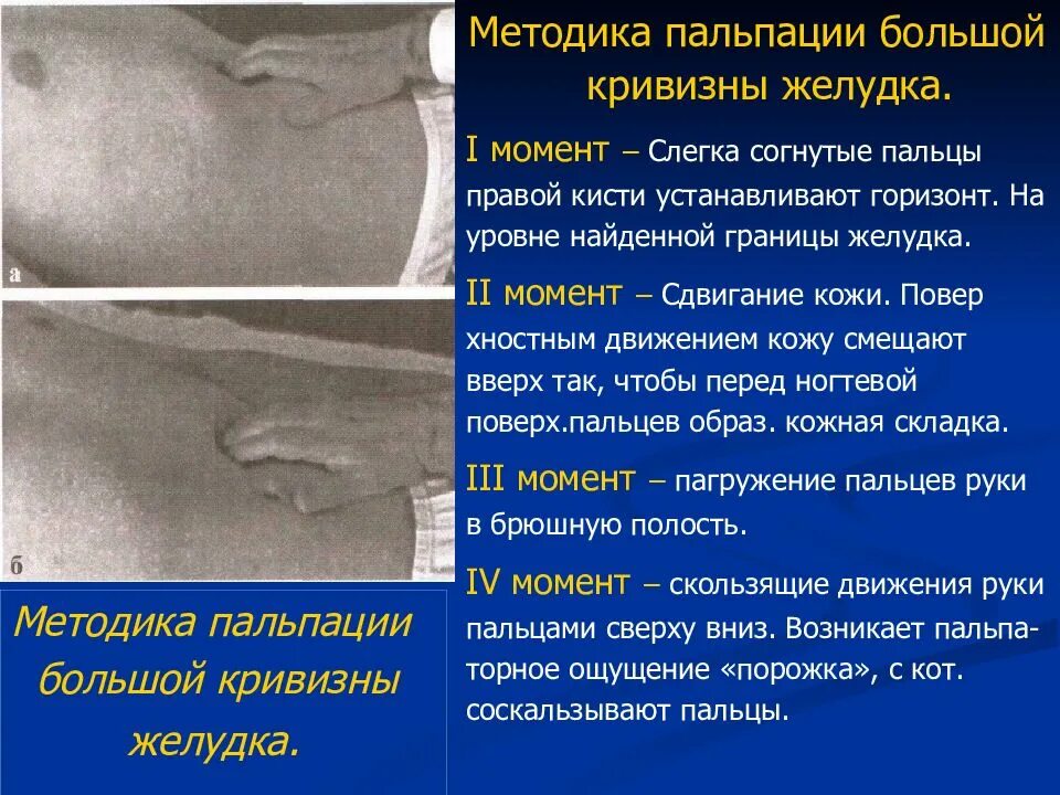 Больно живот при пальпации. Пальпация желудка пропедевтика. методика пальпации живота. поверхностная пальпация жкт. методика глубокой пальпации живота.