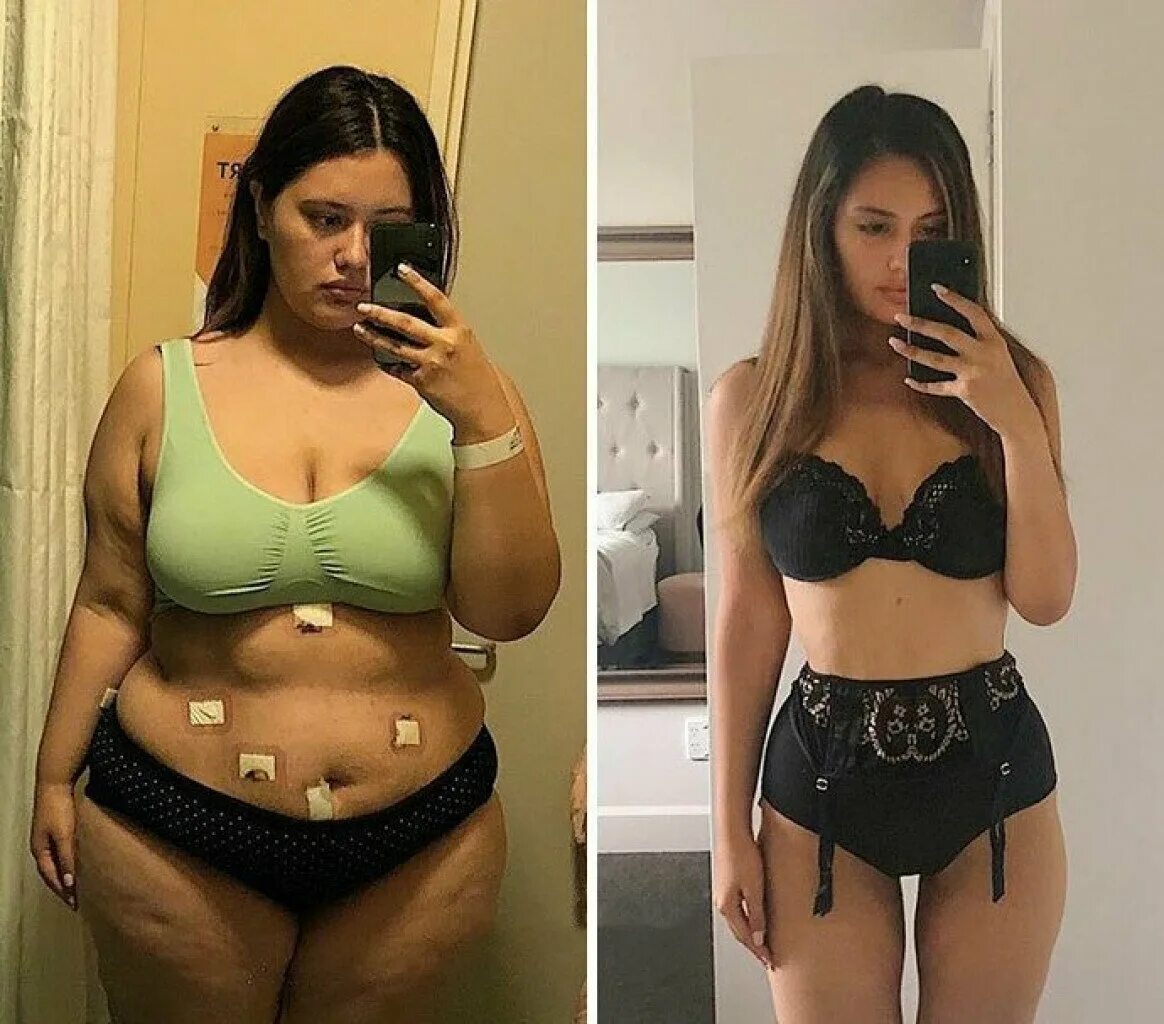 Худеем после 30. Похудение до и после. До и после похудения девушки. Похудела до и после.