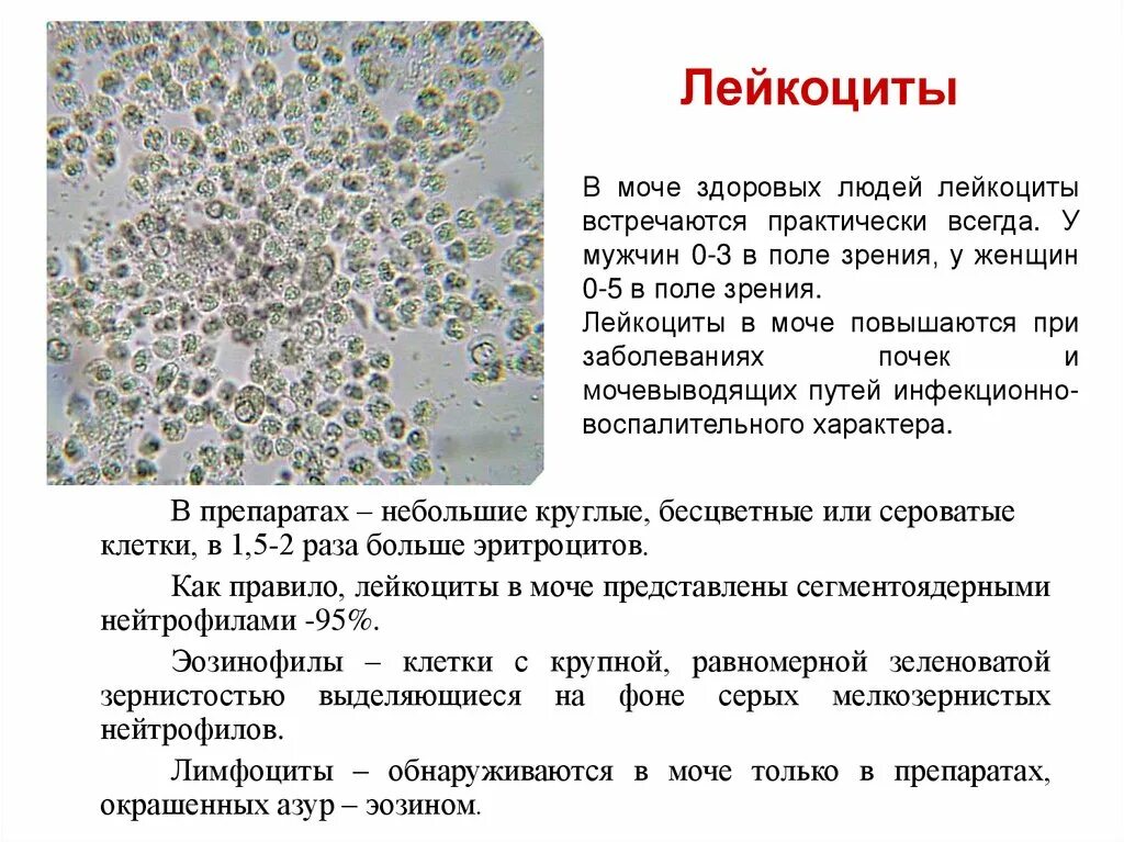 Сильно повышены лейкоциты в моче. Микроскопическое исследование мочевого осадка лейкоциты 0-2-2. Лейкоциты в моче микроскопия. Моча лейкоциты (микроскопия) 2/ПВУ. Лейкоциты 2-3-4 в моче.