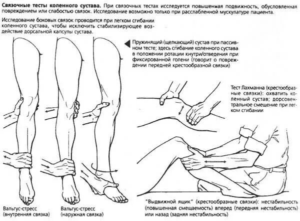 Тесты повреждение боковых связок коленного сустава. Признаки повреждения связок коленного сустава. Диагностика повреждений боковых связок коленного сустава. Разрыв связок коллатеральных связок.