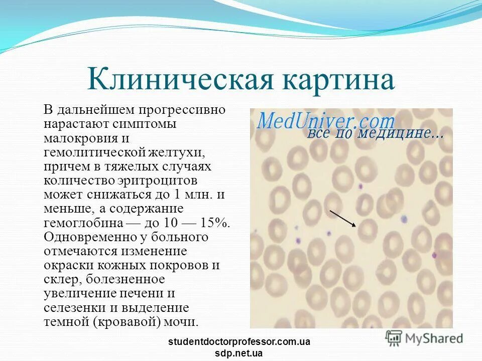 Эритроциты 2 в моче у ребенка. Эритроциты 2 в моче у ребенка