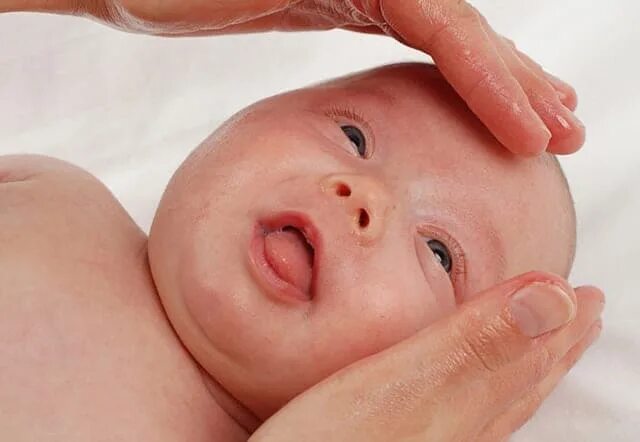 Массаж слезного канала видео. Дакриоцистит новорожденных. Массаж носослезного канала новорожденных. Массаж слезного канала у новорожденных. Массаж носослезного канала у новорожденного.