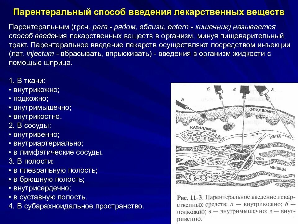 Парентеральное введение лекарственных средств это. Пути парентерального введения лекарственных препаратов. Способы введения лекарственных средств. Способы внутривенного введения лекарственных средств. Парентеральные методы введения лекарственных средств.