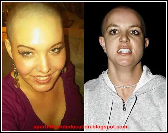 Операция на смену пола. Смена пола. Пластическая операция по изменению пола. Переделанные из мужчин в женщин. Из мужчины в женщину.