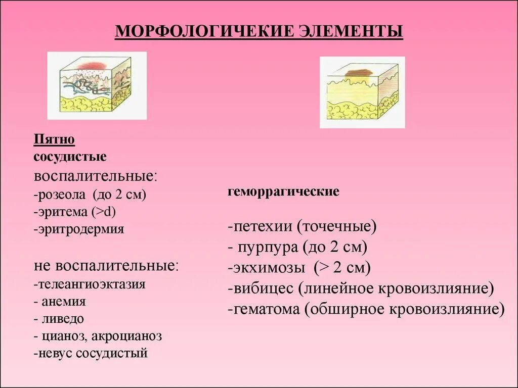 К вторичным элементам относится