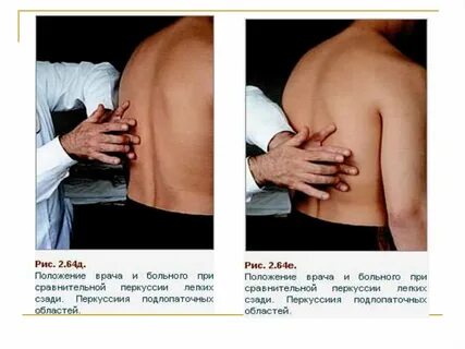 Боли перкуссия