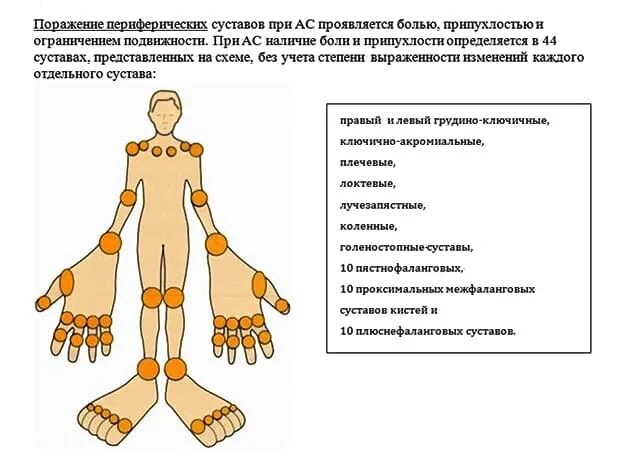 Периферические суставы это